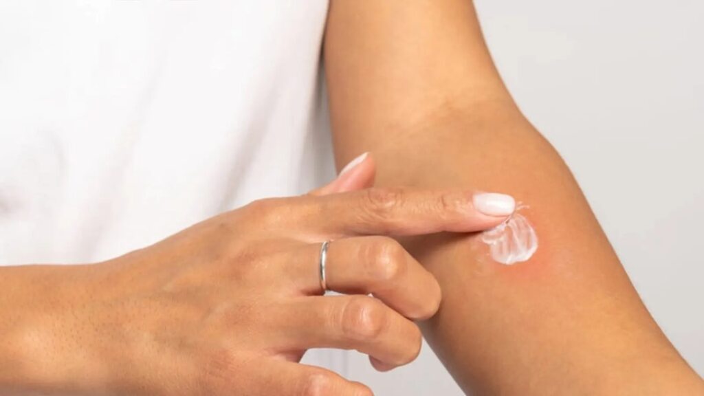 Discover effective natural remedies for old scars to improve skin appearance and promote healing over time.