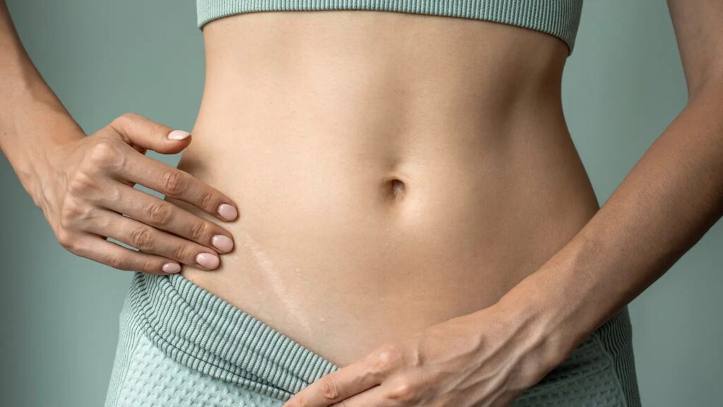 Scar removal for old scars offers effective solutions to improve skin appearance and boost confidence.