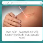 Best Scar Treatment for Old Scars: 5 Methods That Actually Work