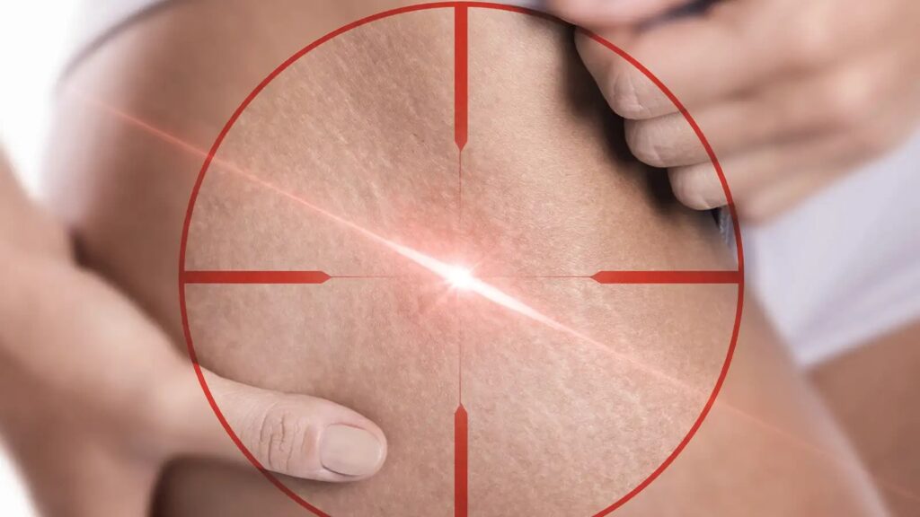 Laser therapy is an effective treatment option for various medical conditions and pain relief.