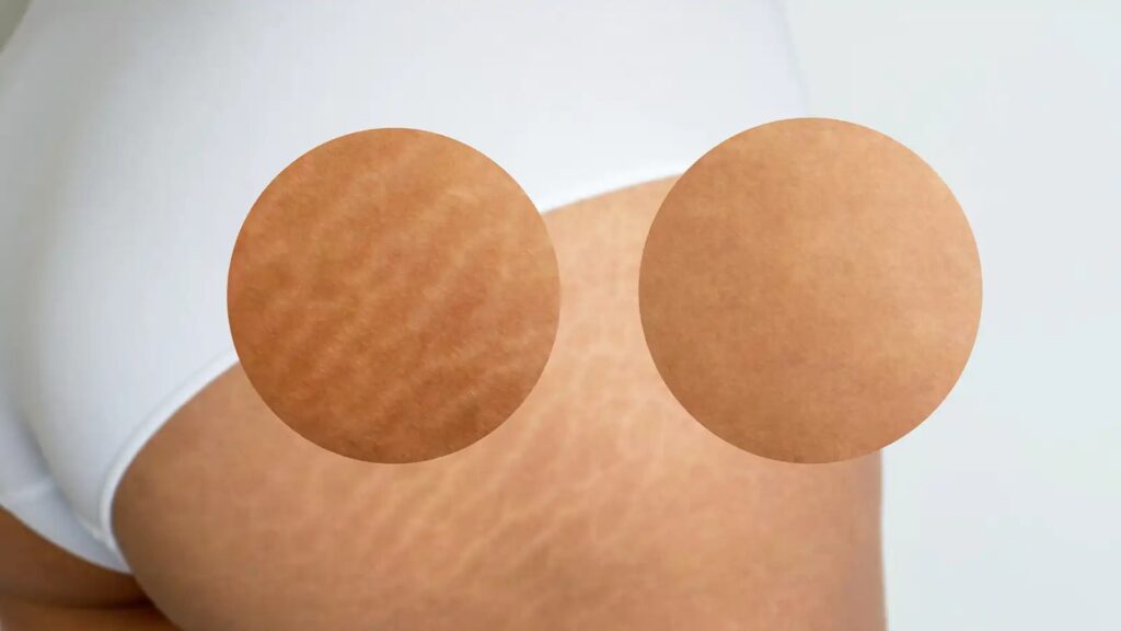 Skin treatments are commonly used to improve the appearance and health of the skin.