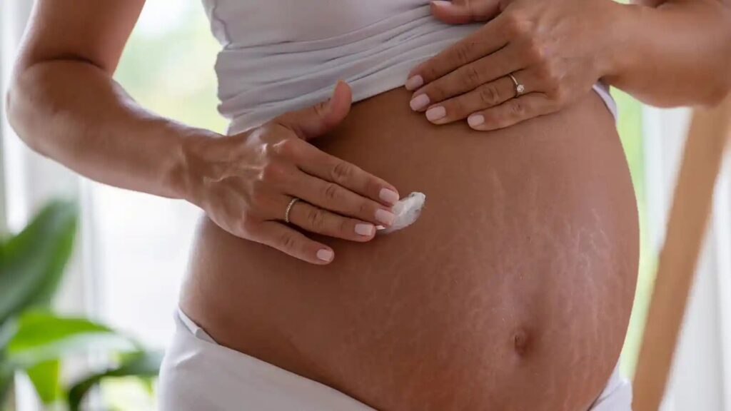 Effective stretch mark treatment can improve your skin’s texture and boost your confidence.