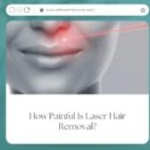 How Painful Is Laser Hair Removal?