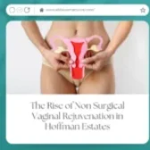 The Rise of Non Surgical Vaginal Rejuvenation in Hoffman Estates