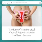 The Rise of Non Surgical Vaginal Rejuvenation in Hoffman Estates