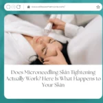 Does Microneedling Skin Tightening Actually Work? Here Is What Happens to Your Skin