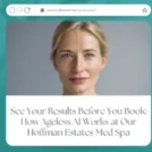 See Your Results Before You Book: How Ageless AI Works at Our Hoffman Estates Med Spa