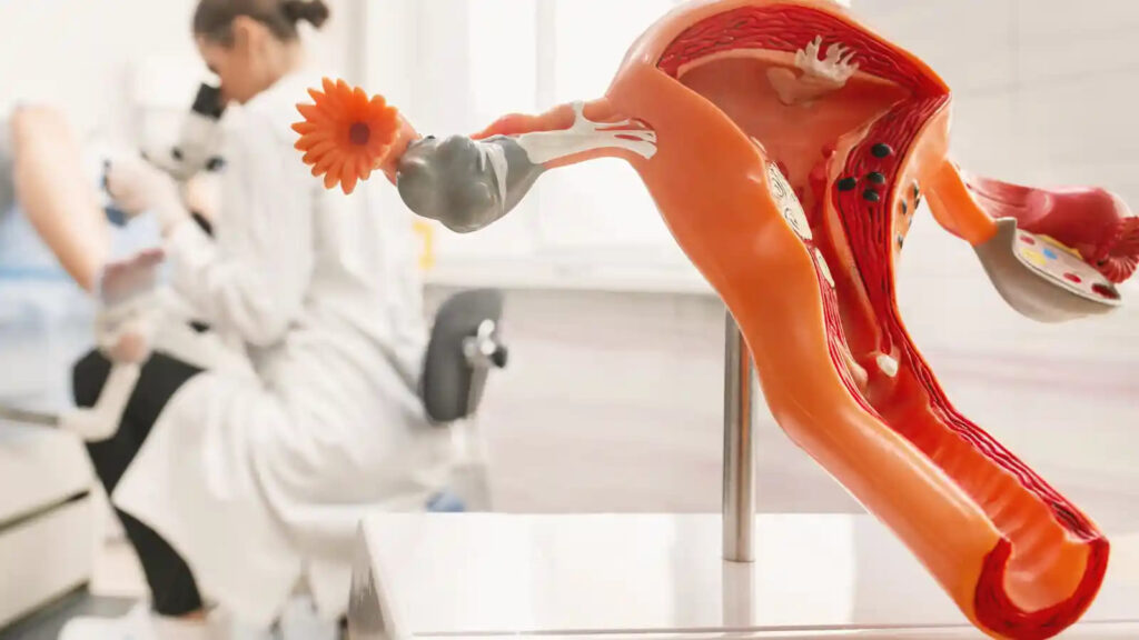 Discover effective at-home remedies for endometriosis to ease pain naturally and safely.