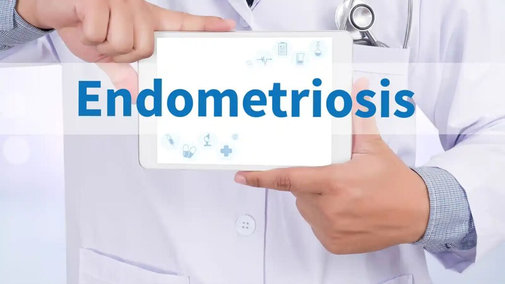 Natural remedies for endometriosis provide alternative options to support symptom relief and improve quality of life.